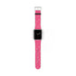 Pink Bow Coquette Watch Band ONLY — Cute Ribbon-Stripes Apple Watch Strap